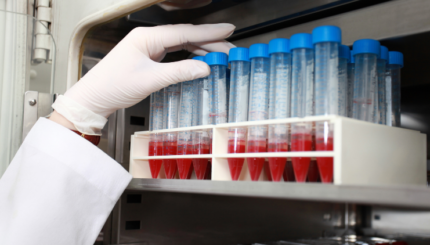 Pemantauan Suhu Kulkas Bank Darah Berbasis IoT